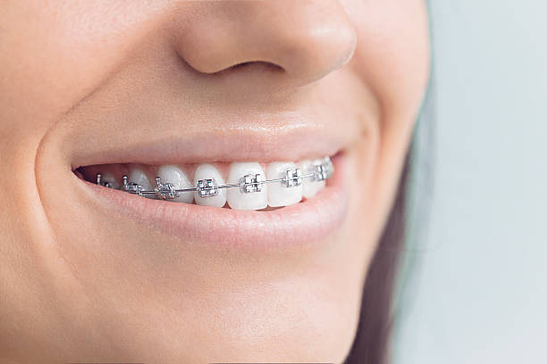 Full Mouth Reconstruction in Linden, AZ